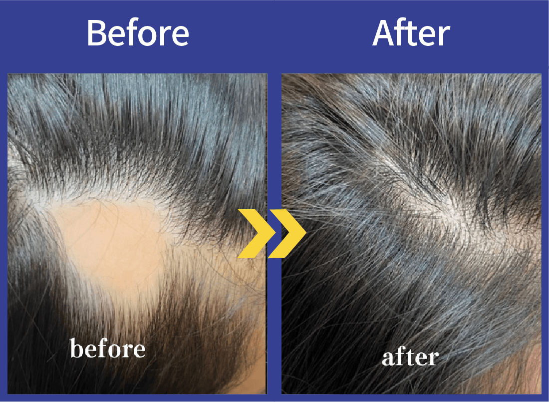 Before After