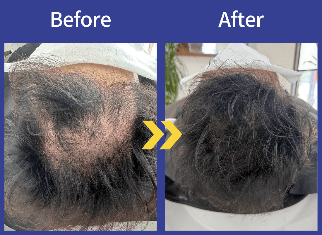 Before After