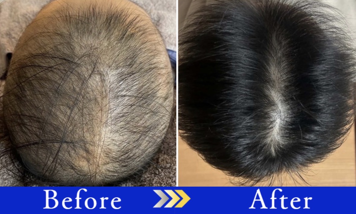 Before After はなおさん